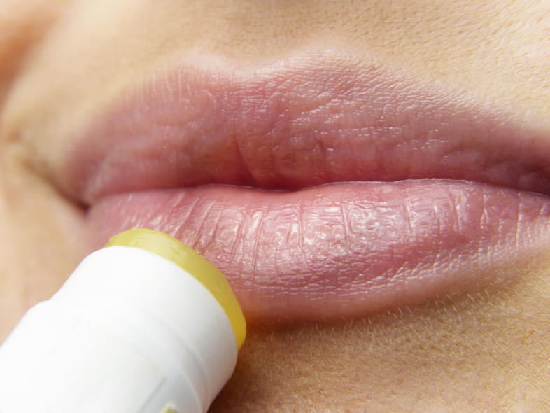 Los labios agrietados son un síntoma de alergia a la nicotina